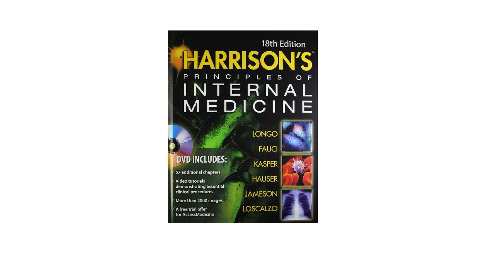 ハリソン内科学 18版  2巻セット  英語版 Harrison's Principles of Internal Medicine, Volume 2